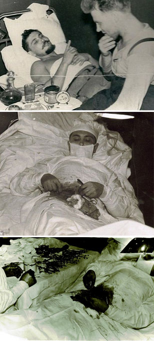 Operating His Own Appendix The Story of the Surgeon Who Removed His Own Appendix